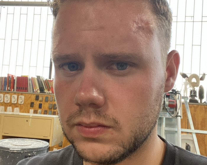 Tanner Hoffman Face Of Horror